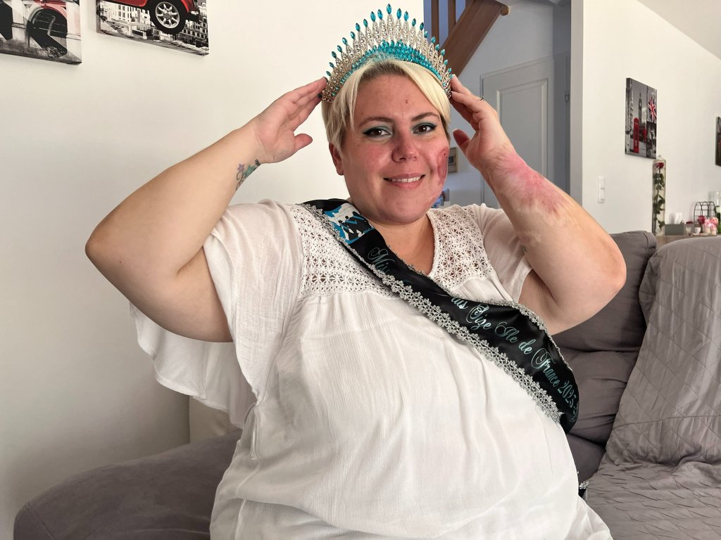 Stéphanie Mercier : &laquo;&nbsp;Il n&rsquo;y a pas un seul jour où je n&rsquo;ai pas de pansement sur moi&nbsp;&raquo;